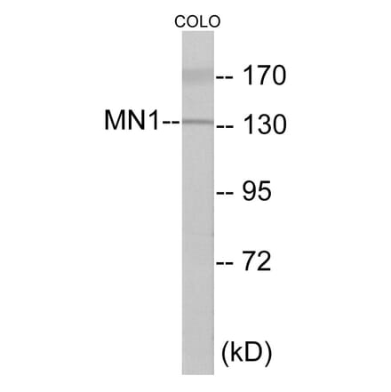 Western Blot - MN1 Cell Based ELISA Kit (CB5971) - Antibodies.com