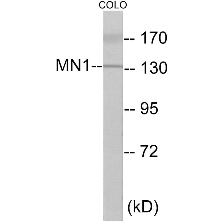 Western Blot - MN1 Cell Based ELISA Kit (CB5971) - Antibodies.com