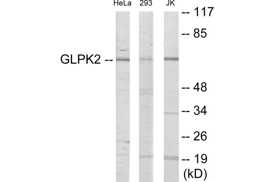 Western Blot - GK2 Cell Based ELISA Kit (CB6004) - Antibodies.com