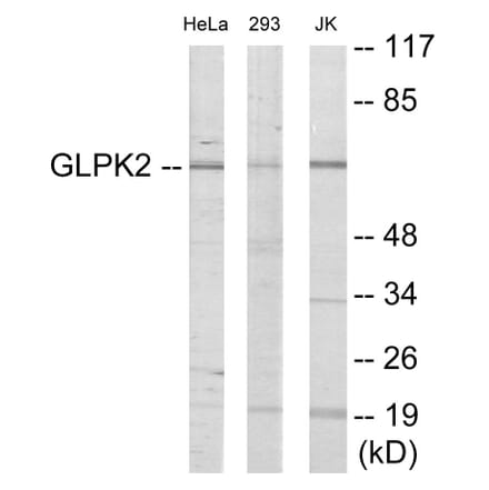 Western Blot - GK2 Cell Based ELISA Kit (CB6004) - Antibodies.com