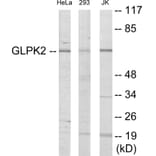 Western Blot - GK2 Cell Based ELISA Kit (CB6004) - Antibodies.com