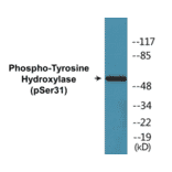 Western Blot - Tyrosine Hydroxylase (phospho Ser31) Cell Based ELISA Kit (FLUO-CBP1036) - Antibodies.com