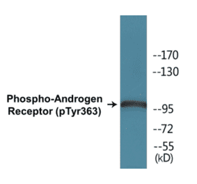 Western Blot - Androgen Receptor (phospho Tyr363) Cell Based ELISA Kit (FLUO-CBP1777) - Antibodies.com