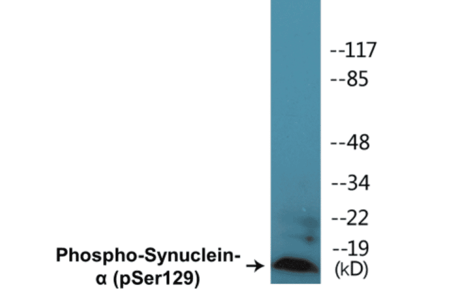 Western Blot - alpha Synuclein (phospho Ser129) Cell Based ELISA Kit (FLUO-CBP1221) - Antibodies.com