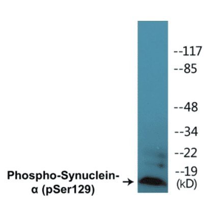 Western Blot - alpha Synuclein (phospho Ser129) Cell Based ELISA Kit (FLUO-CBP1221) - Antibodies.com