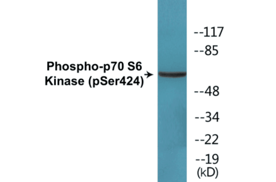 Western Blot - p70 S6 Kinase (phospho Ser424) Cell Based ELISA Kit (FLUO-CBP1651) - Antibodies.com