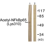 Western Blot - NF-kappaB p65 (acetyl Lys310) Cell Based ELISA Kit (FLUO-CBP1886) - Antibodies.com