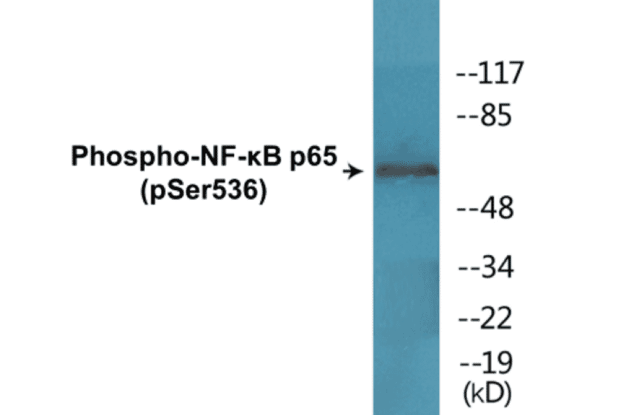 Western Blot - NF-kB p65 (phospho Ser536) Cell Based ELISA Kit (FLUO-CBP1633) - Antibodies.com