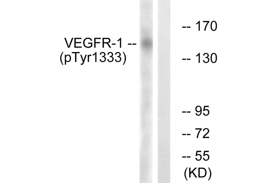 Western Blot - VEGFR1 (phospho Tyr1333) Cell Based ELISA Kit (FLUO-CBP1873) - Antibodies.com