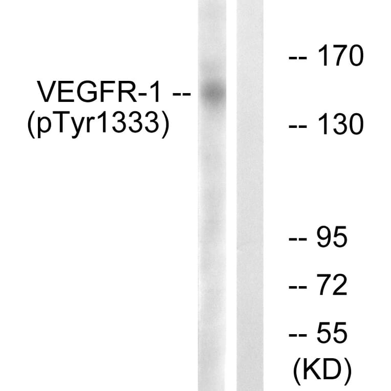 Western Blot - VEGFR1 (phospho Tyr1333) Cell Based ELISA Kit (FLUO-CBP1873) - Antibodies.com