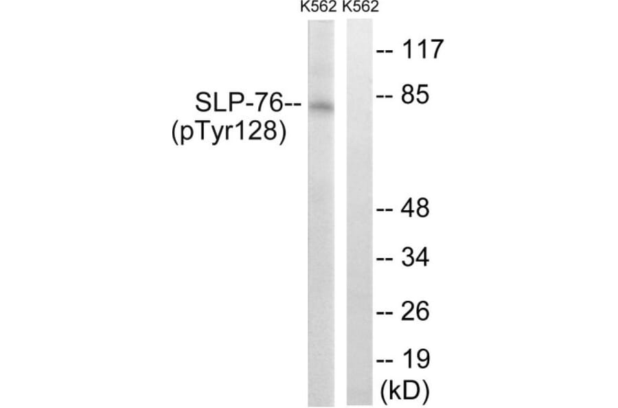 Western Blot - SLP-76 (phospho Tyr128) Cell Based ELISA Kit (FLUO-CBP1885) - Antibodies.com