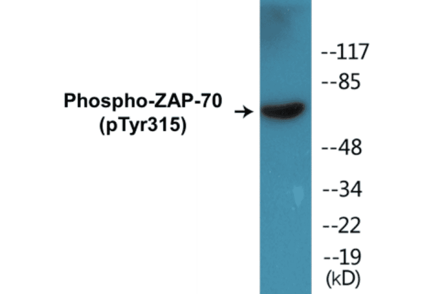 Western Blot - ZAP-70 (phospho Tyr315) Cell Based ELISA Kit (FLUO-CBP1235) - Antibodies.com