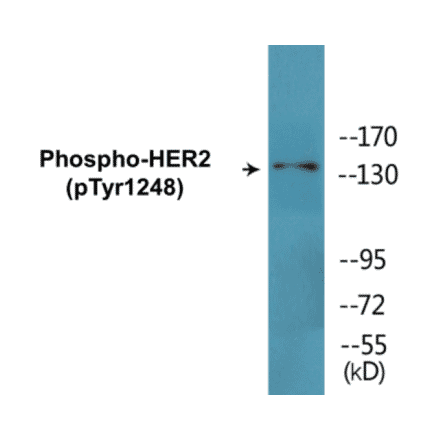 Western Blot - HER2 (phospho Tyr1248) Cell Based ELISA Kit (FLUO-CBP1573) - Antibodies.com
