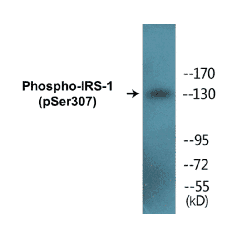 Western Blot - IRS-1 (phospho Ser307) Cell Based ELISA Kit (FLUO-CBP1090) - Antibodies.com