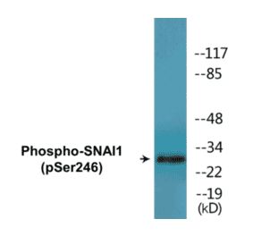 Western Blot - SNAI1 (phospho Ser246) Cell Based ELISA Kit (FLUO-CBP1479) - Antibodies.com