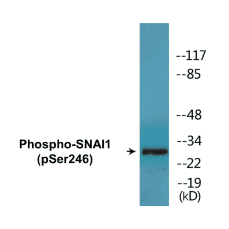 Western Blot - SNAI1 (phospho Ser246) Cell Based ELISA Kit (FLUO-CBP1479) - Antibodies.com