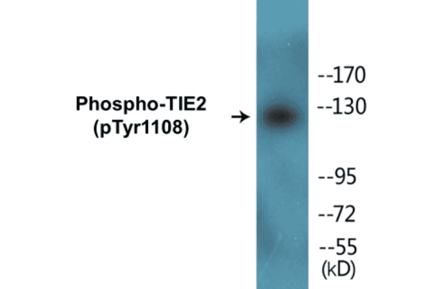 Western Blot - TIE2 (phospho Tyr1108) Cell Based ELISA Kit (FLUO-CBP1223) - Antibodies.com