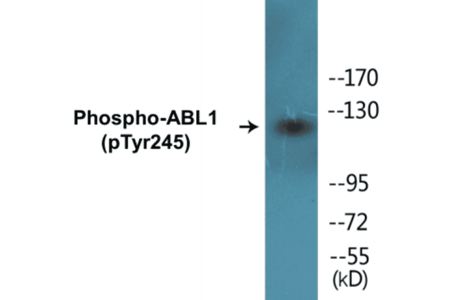 Western Blot - ABL1 (phospho Tyr245) Cell Based ELISA Kit (FLUO-CBP1245) - Antibodies.com