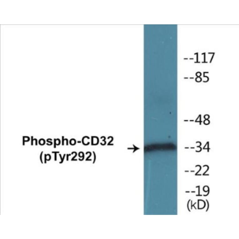 Western Blot - CD32 (phospho Tyr292) Cell Based ELISA Kit (FLUO-CBP1246) - Antibodies.com