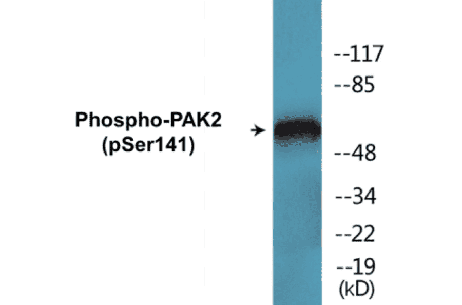 Western Blot - PAK2 (phospho Ser141) Cell Based ELISA Kit (FLUO-CBP1763) - Antibodies.com