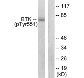 Western Blot - BTK (phospho Tyr551) Cell Based ELISA Kit (FLUO-CBP1872) - Antibodies.com