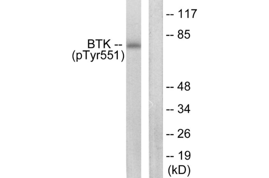 Western Blot - BTK (phospho Tyr551) Cell Based ELISA Kit (FLUO-CBP1872) - Antibodies.com