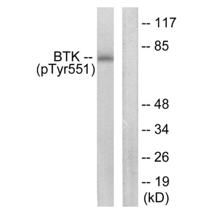 Western Blot - BTK (phospho Tyr551) Cell Based ELISA Kit (FLUO-CBP1872) - Antibodies.com