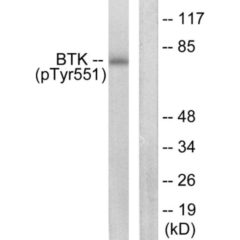 Western Blot - BTK (phospho Tyr551) Cell Based ELISA Kit (FLUO-CBP1872) - Antibodies.com