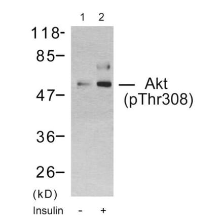Western Blot - Akt (phospho Thr308) Cell Based ELISA Kit (FLUO-CBP1879) - Antibodies.com