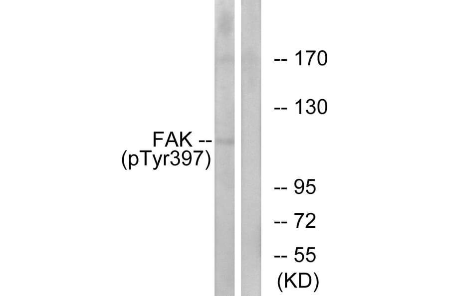 Western Blot - FAK (phospho Tyr397) Cell Based ELISA Kit (FLUO-CBP1880) - Antibodies.com