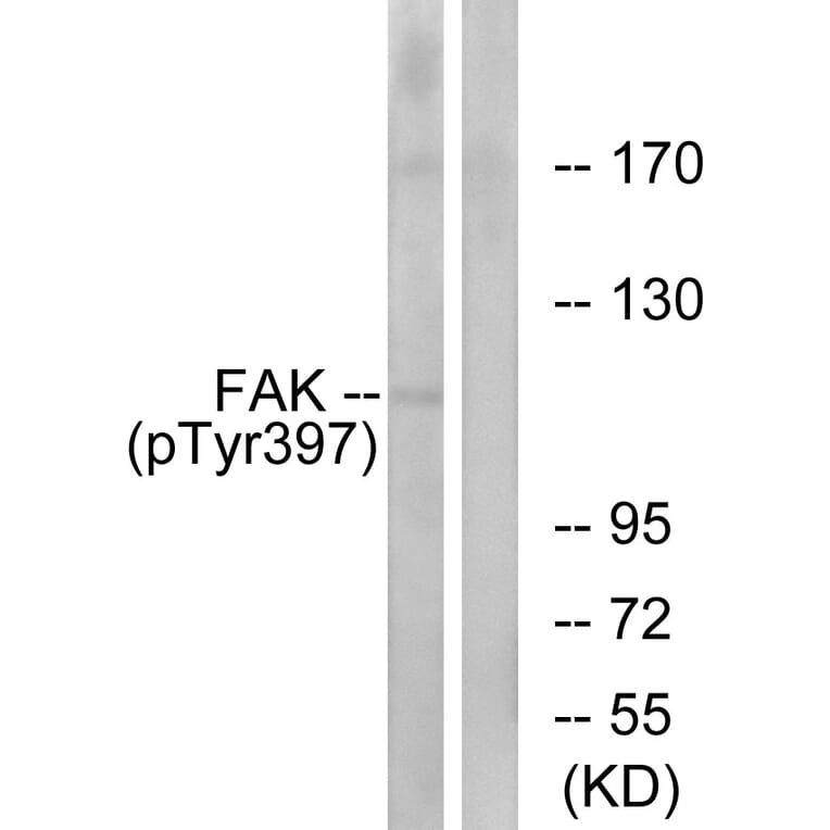 Western Blot - FAK (phospho Tyr397) Cell Based ELISA Kit (FLUO-CBP1880) - Antibodies.com
