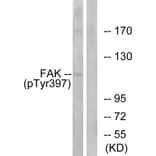 Western Blot - FAK (phospho Tyr397) Cell Based ELISA Kit (FLUO-CBP1880) - Antibodies.com