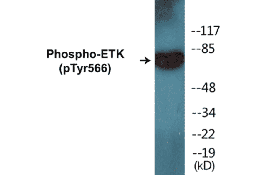 Western Blot - ETK (phospho Tyr566) Cell Based ELISA Kit (FLUO-CBP1300) - Antibodies.com