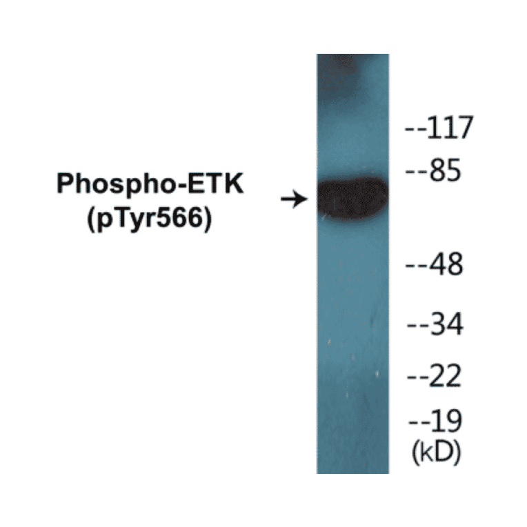 Western Blot - ETK (phospho Tyr566) Cell Based ELISA Kit (FLUO-CBP1300) - Antibodies.com