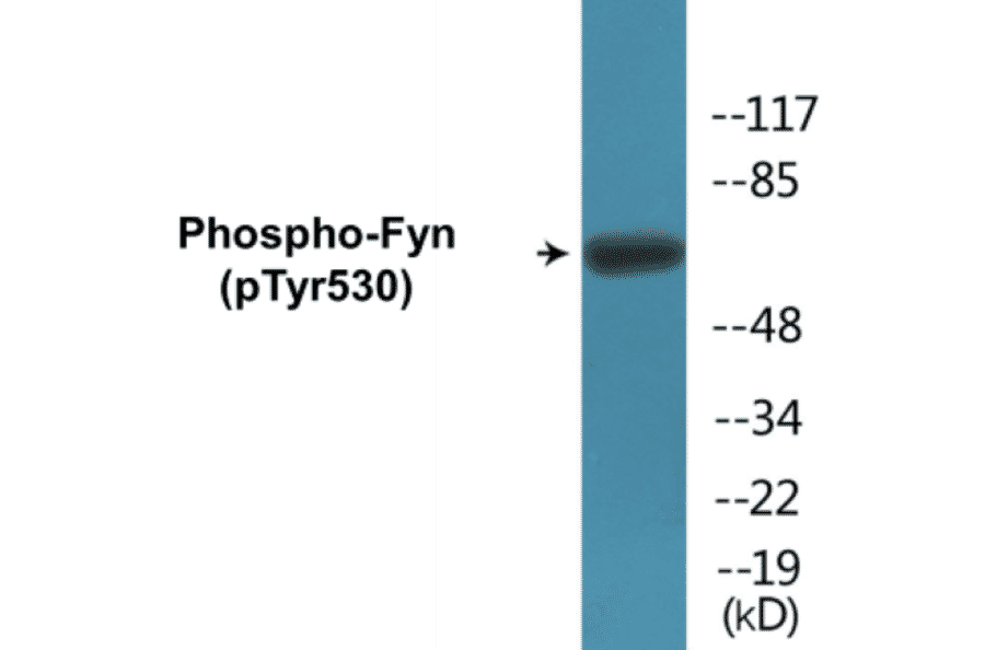 Western Blot - Fyn (phospho Tyr530) Cell Based ELISA Kit (FLUO-CBP1118) - Antibodies.com