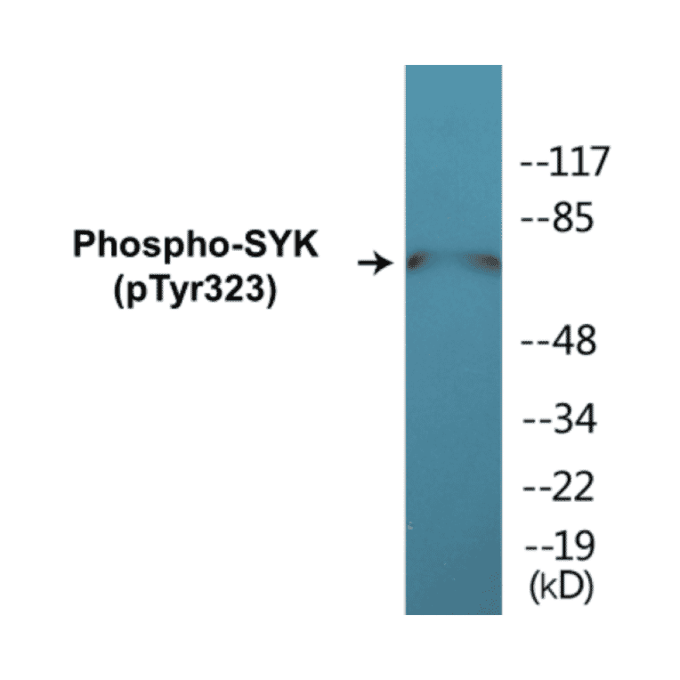 Western Blot - SYK (phospho Tyr323) Cell Based ELISA Kit (FLUO-CBP1219) - Antibodies.com