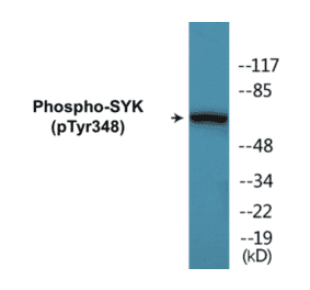 Western Blot - SYK (phospho Tyr348) Cell Based ELISA Kit (FLUO-CBP1084) - Antibodies.com