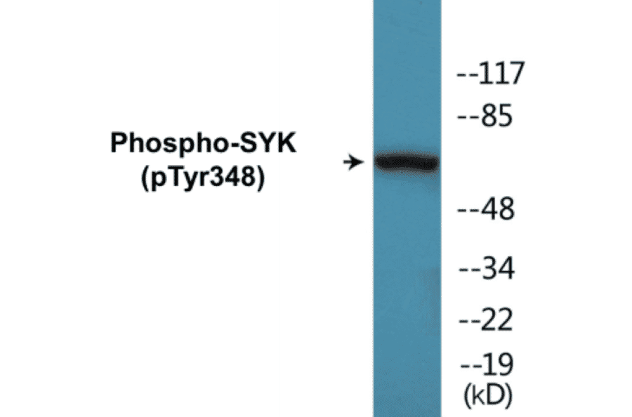 Western Blot - SYK (phospho Tyr348) Cell Based ELISA Kit (FLUO-CBP1084) - Antibodies.com