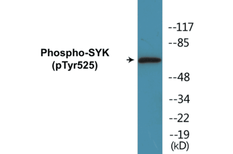 Western Blot - SYK (phospho Tyr525) Cell Based ELISA Kit (FLUO-CBP1085) - Antibodies.com