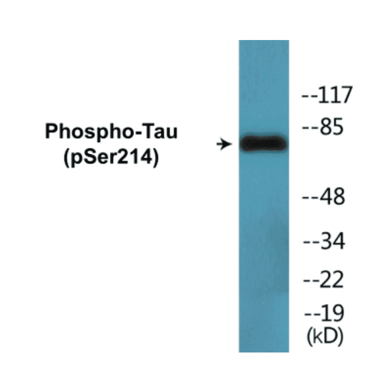 Western Blot - Tau (phospho Ser214) Cell Based ELISA Kit (FLUO-CBP1693) - Antibodies.com