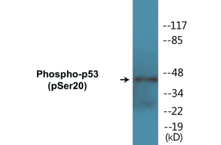 Western Blot - p53 (phospho Ser20) Cell Based ELISA Kit (FLUO-CBP1187) - Antibodies.com