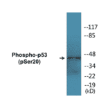 Western Blot - p53 (phospho Ser20) Cell Based ELISA Kit (FLUO-CBP1187) - Antibodies.com