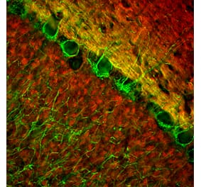 Immunofluorescence - Anti-NF-L Antibody [1B11] (A104310) - Antibodies.com