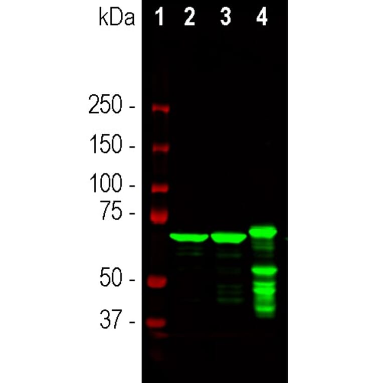 Western Blot - Anti-NF-L Antibody [1B11] (A104310) - Antibodies.com