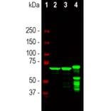 Western Blot - Anti-NF-L Antibody [1B11] (A104310) - Antibodies.com