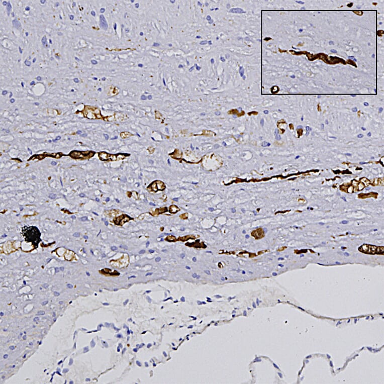 Immunohistochemistry - Anti-NF-L Antibody [1B11] (A104310) - Antibodies.com