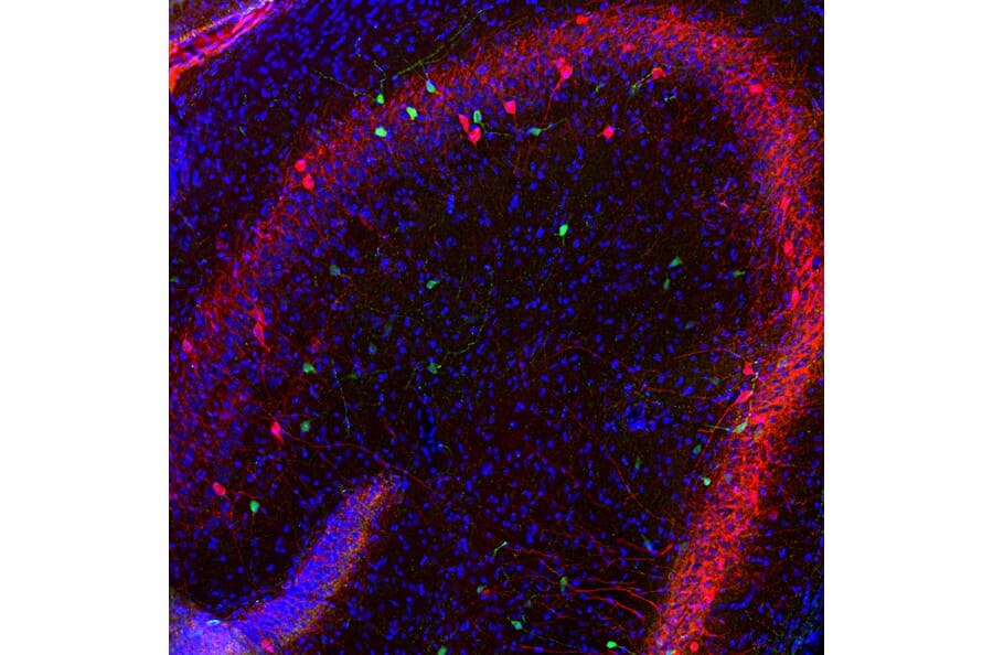 Immunofluorescence - Anti-Calretinin Antibody (A104312) - Antibodies.com