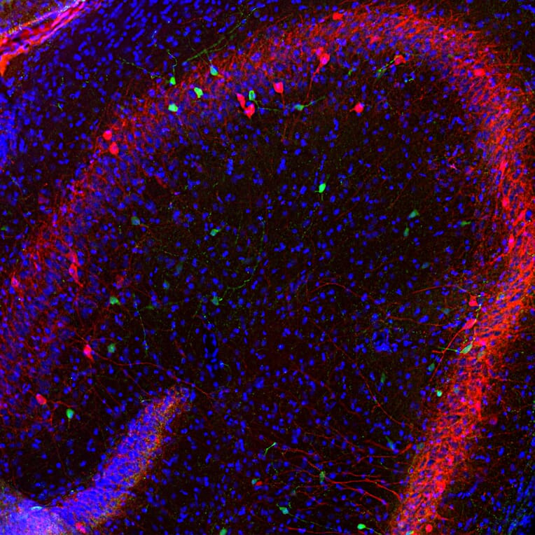 Immunofluorescence - Anti-Calretinin Antibody - Antibodies.com (A104312)