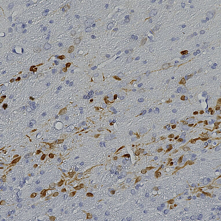 Immunohistochemistry - Anti-Calretinin Antibody (A104312) - Antibodies.com