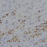 Immunohistochemistry - Anti-Calretinin Antibody (A104312) - Antibodies.com